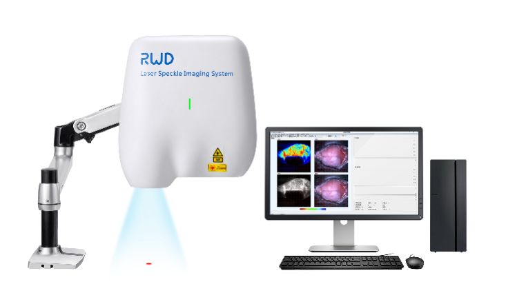 RWD激光散斑血流成像系統(tǒng)RFLSI Ⅲ.png