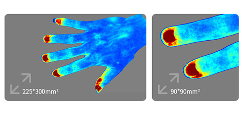 RFLSI ZW激光散斑血流成像系統(tǒng)，無與倫比的成像體驗 