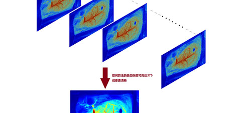 RFLSI ZW激光散斑血流成像系統(tǒng)，無與倫比的成像體驗 