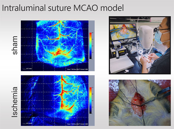 瑞沃德激光散斑血流成像系統(tǒng)使用分享
