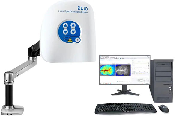 瑞沃德激光散斑血流成像系統(tǒng)