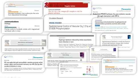 激光散斑血流成像系統(tǒng)對(duì)腦卒中研究的價(jià)值