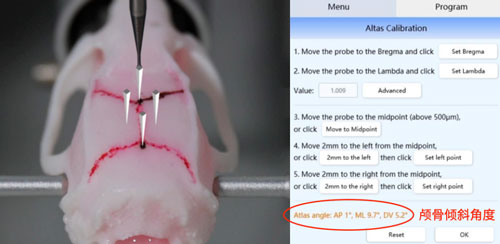 全自動(dòng)腦立體定位儀新升級(jí)~無(wú)需調(diào)平，精準(zhǔn)定位！| 特邀專欄