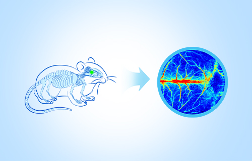 腦血流監(jiān)測