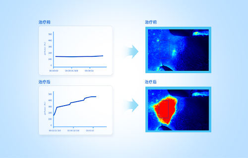 皮膚的血流監(jiān)測
